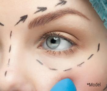 Eyelid surgery from surgeon in Beverly Hills