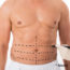 Liposuction and Body Contouring for Men