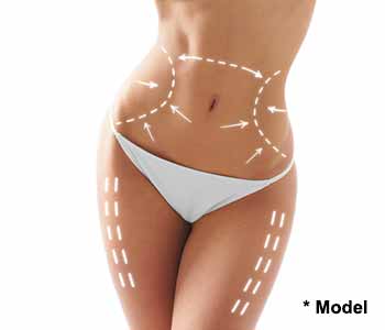 Beverly Hills, CA physician Dr. Dennis Dass explains results of liposuction surgery