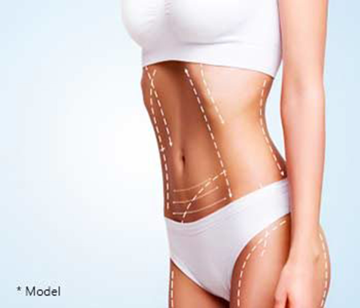 Plastic Surgeon in Beverly Hills Explains the Benefits of Liposuction