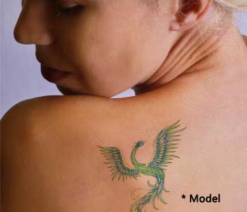 Successful tattoo removal from Beverly Hills area Doctor