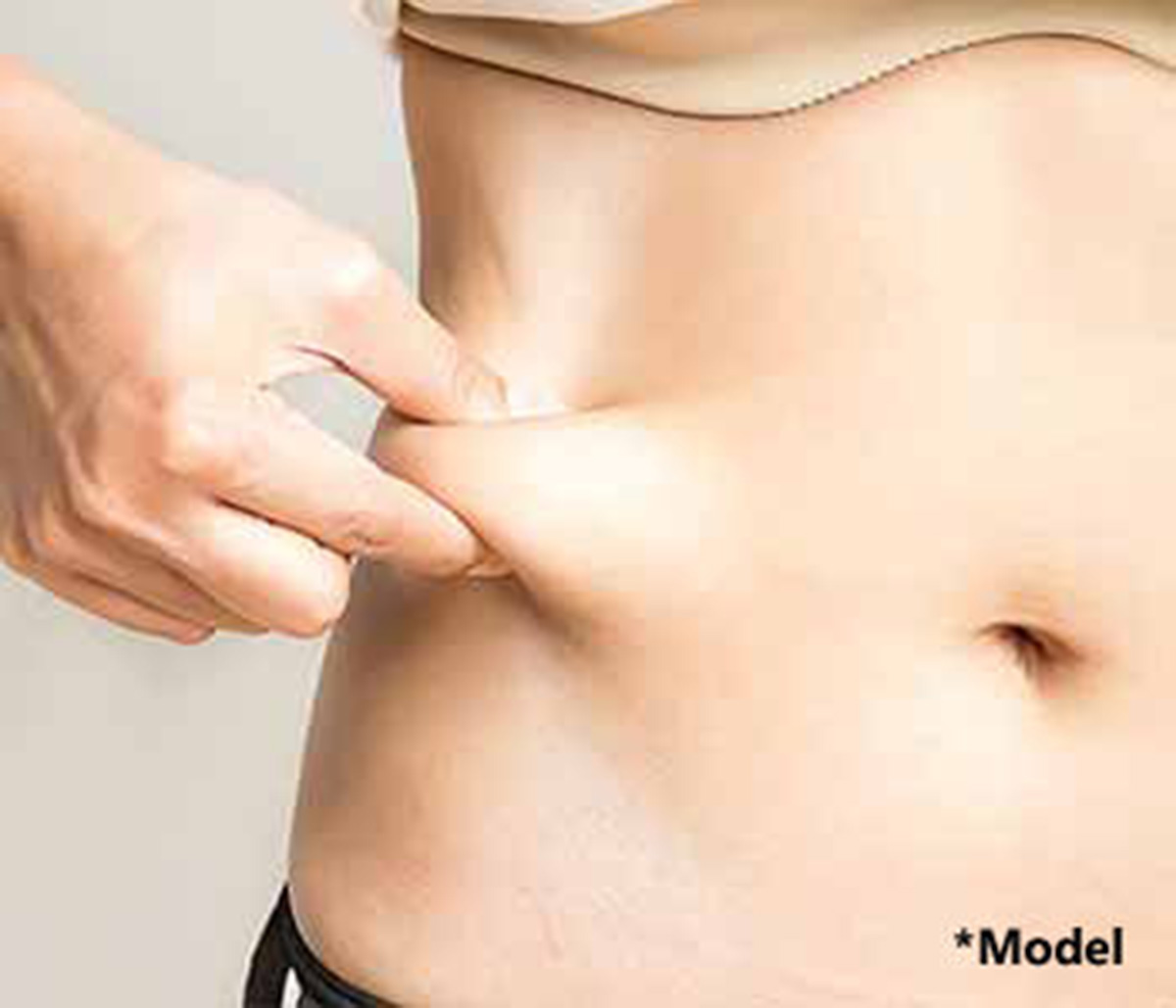 Dr. Dennis Dass explains, difference between a tummy tuck and liposuction