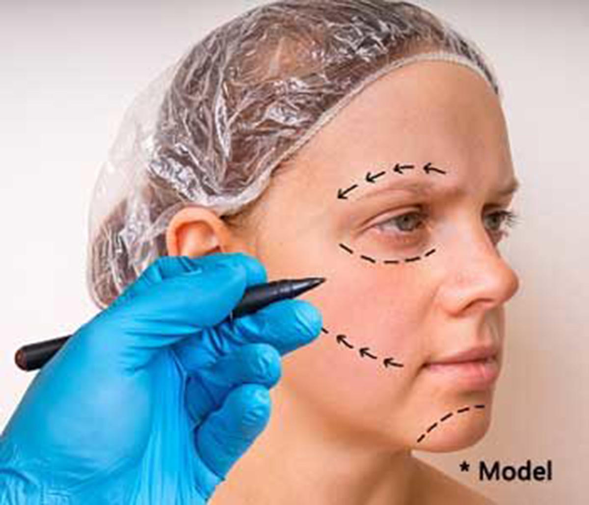Face Botox treatment, Dennis Dass, MD