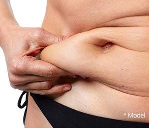 Important Facts About Tummy Tuck in Beverly Hills area