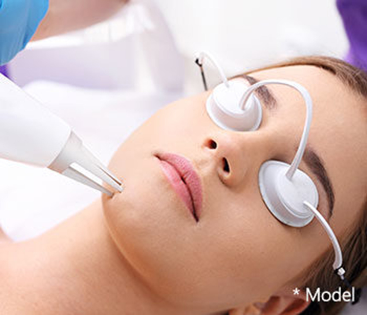 Patients enjoy treatment for wrinkles with PicoSure laser facials near Beverly Hills