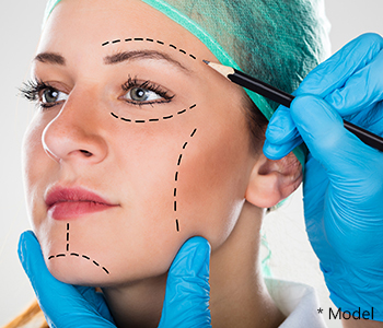 Which patients are proper candidates for facelift surgery